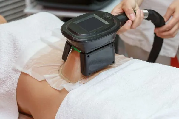 Image of person having fat freezing treatment to help weight gain Tamworth