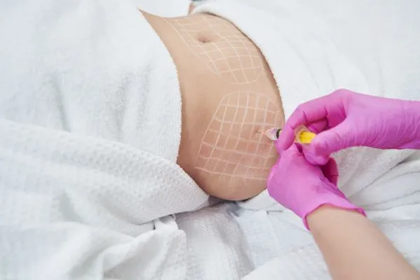 image of fat dissolving injections on love handles to help combat weight gain Tamworth