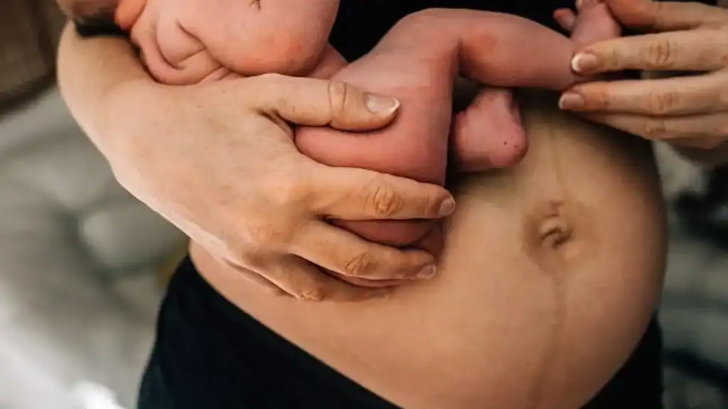 Why Is My Stomach Still Big After Pregnancy Tamworth?